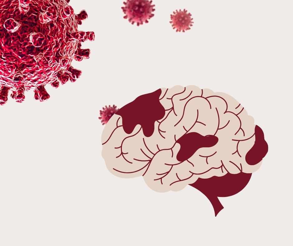 The Surprising Impact of COVID-19 on Stroke Risk and Brain Health